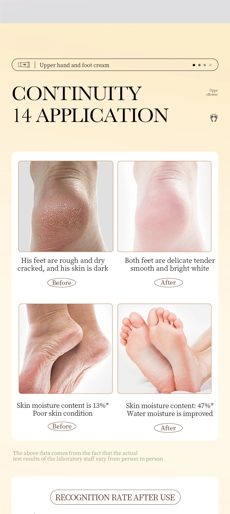 SADOER Shea Butter Foot Cream Moisturizing Anti Wrinkles Anti-Drying Heel Repair Removal Dead Skin Hands and Feet Skin Care