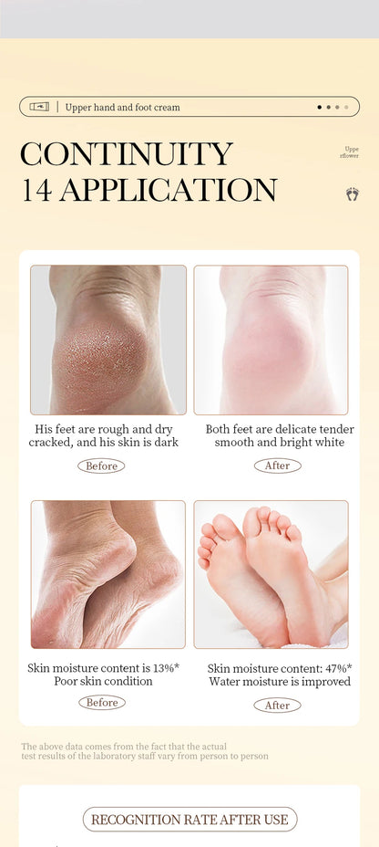 SADOER Shea Butter Foot Cream Moisturizing Anti Wrinkles Anti-Drying Heel Repair Removal Dead Skin Hands and Feet Skin Care