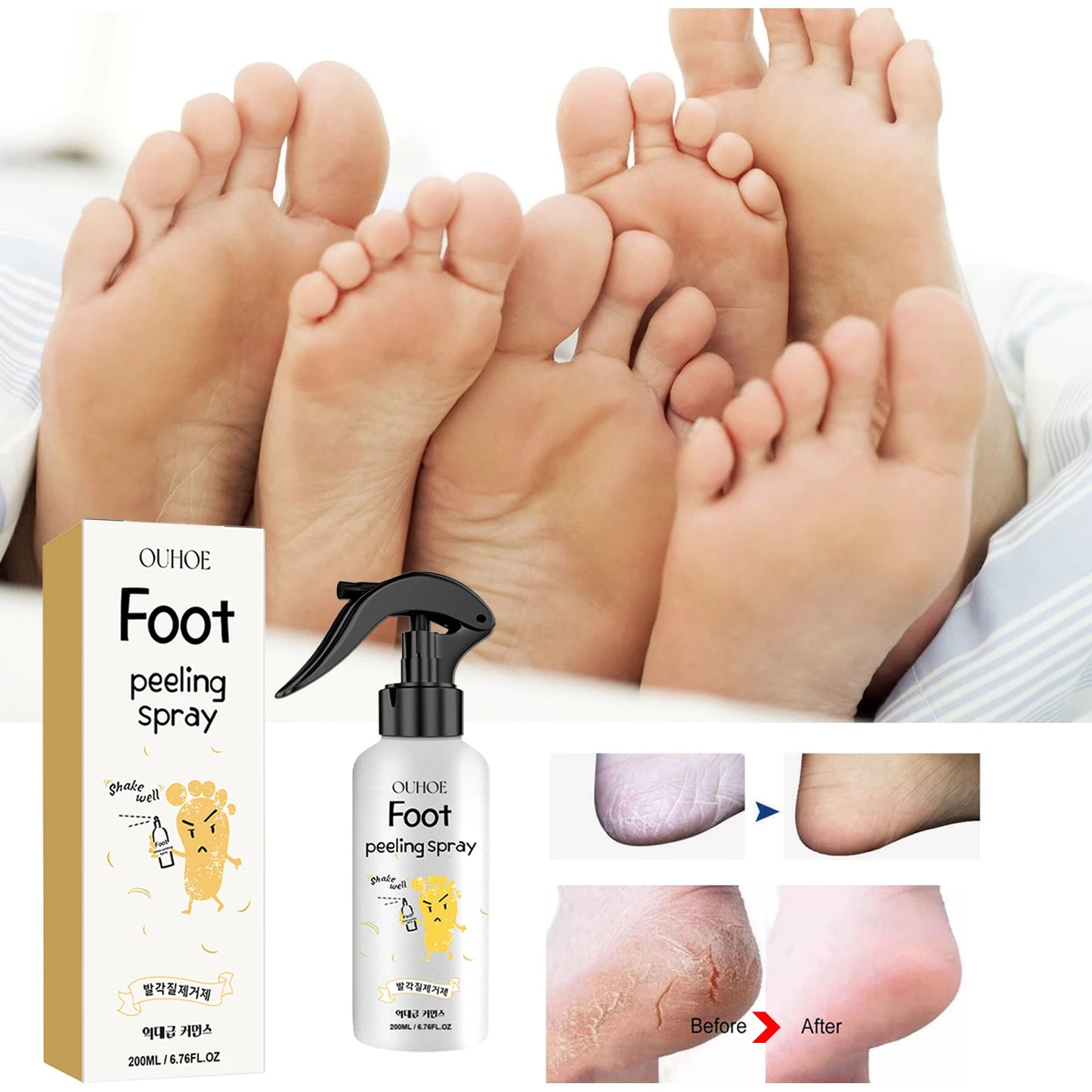 Ouhoe Foot Exfoliating Spray 72H Moisture Lock Callus Softener Anti Dry Crack Repair Odor Control Brightening Foot Care Liquid