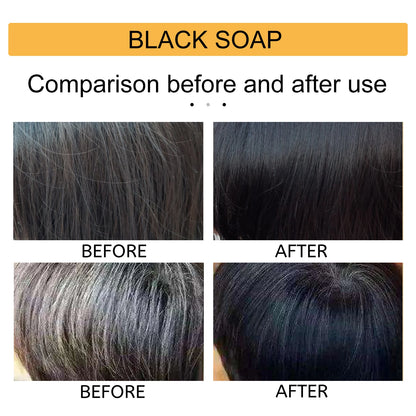 Polygonum Multiflorum Black Hair Shampoo Soap Gentle Coconut Oil Refreshing Oil Control Smoothing Hair Care Handmade Soap