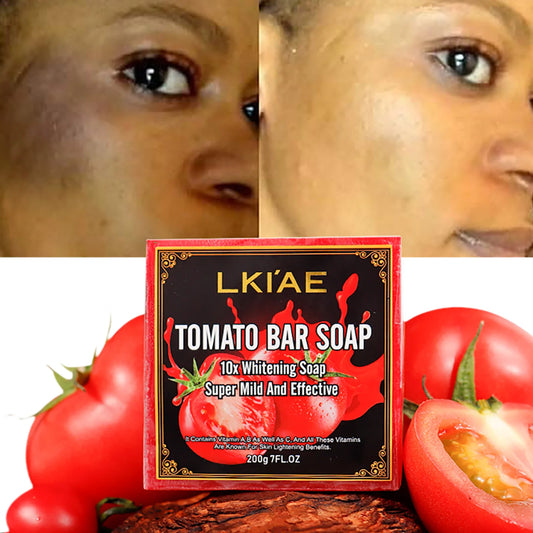 LKIAE Tomato Scented Handmade Soap – Natural Brightening Bar for Face & Body, 200g