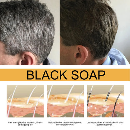 Polygonum Multiflorum Black Hair Shampoo Soap Gentle Coconut Oil Refreshing Oil Control Smoothing Hair Care Handmade Soap