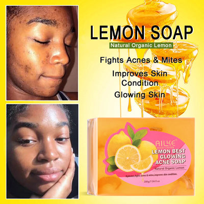 The Lemon Light – Dark Spot & Acne Remover Soap with Olive Oil (200g)