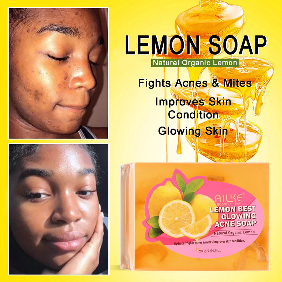 The Lemon Light – Dark Spot & Acne Remover Soap with Olive Oil (200g)