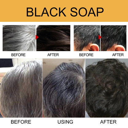 Polygonum Multiflorum Black Hair Shampoo Soap Gentle Coconut Oil Refreshing Oil Control Smoothing Hair Care Handmade Soap