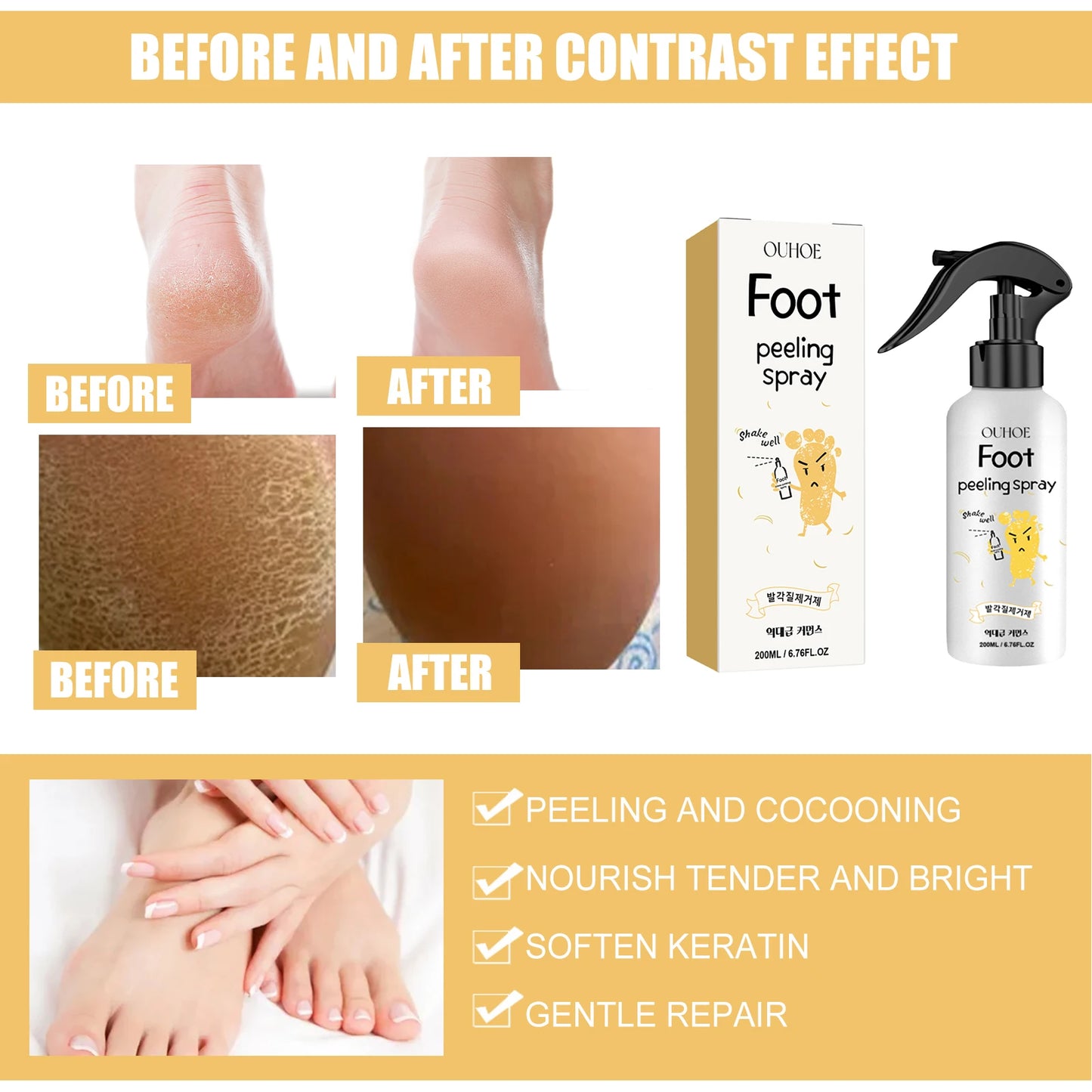 Ouhoe Foot Exfoliating Spray 72H Moisture Lock Callus Softener Anti Dry Crack Repair Odor Control Brightening Foot Care Liquid